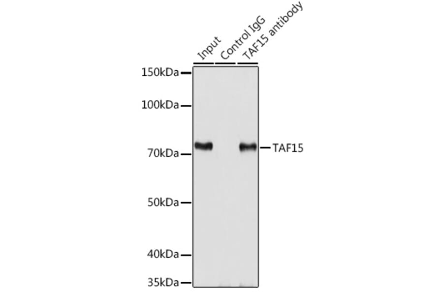 Western Blot - Anti-TAF15 Antibody (A10428) - Antibodies.com