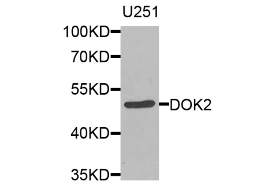 Western Blot - Anti-DOK2 Antibody (A8472) - Antibodies.com