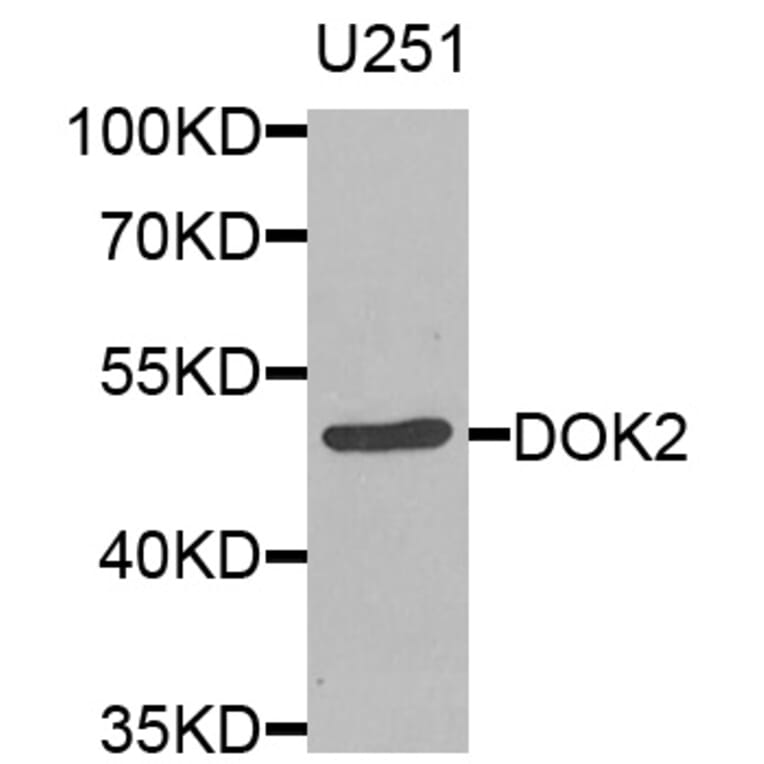 Western Blot - Anti-DOK2 Antibody (A8472) - Antibodies.com