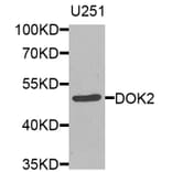 Western Blot - Anti-DOK2 Antibody (A8472) - Antibodies.com