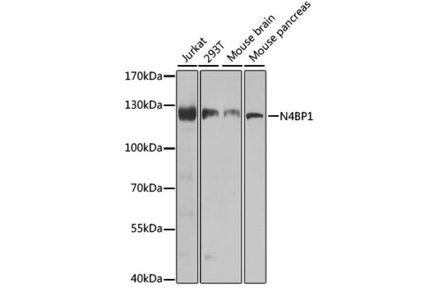 Western Blot - Anti-N4BP1 Antibody (A10430) - Antibodies.com