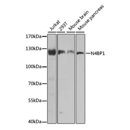 Western Blot - Anti-N4BP1 Antibody (A10430) - Antibodies.com