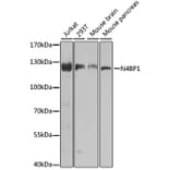 Western Blot - Anti-N4BP1 Antibody (A10430) - Antibodies.com
