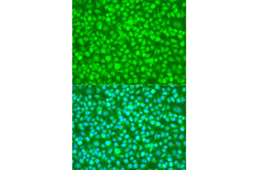 Immunofluorescence - Anti-N4BP1 Antibody (A10430) - Antibodies.com