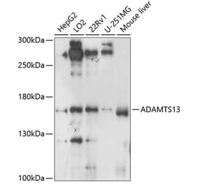 Western Blot - Anti-ADAMTS13 Antibody (A10432) - Antibodies.com