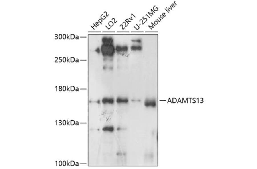 Western Blot - Anti-ADAMTS13 Antibody (A10432) - Antibodies.com