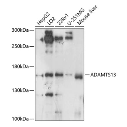 Western Blot - Anti-ADAMTS13 Antibody (A10432) - Antibodies.com