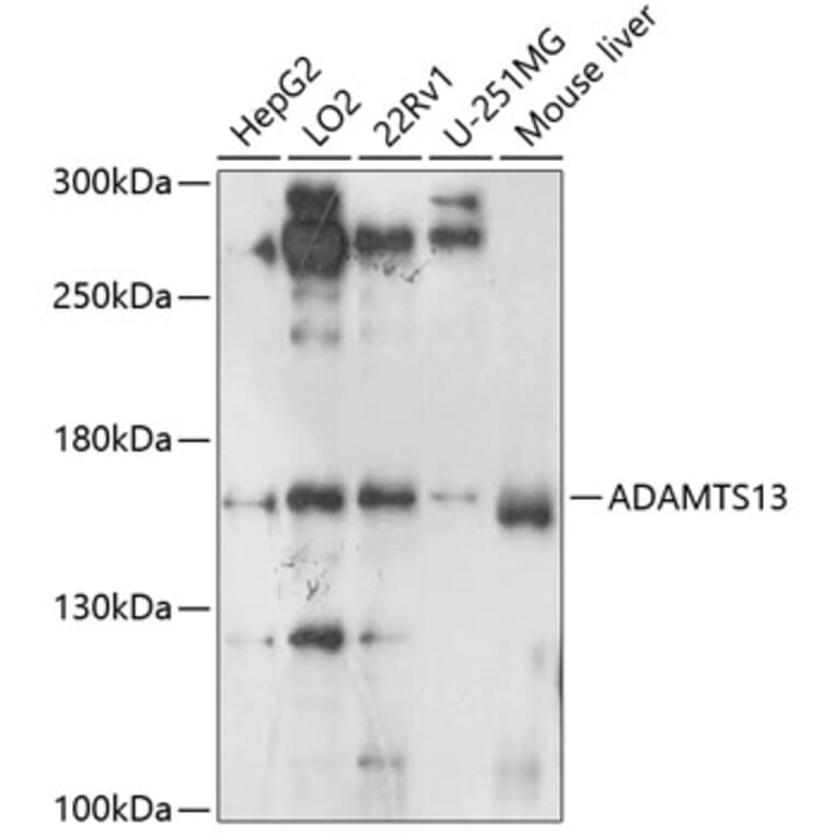 Western Blot - Anti-ADAMTS13 Antibody (A10432) - Antibodies.com