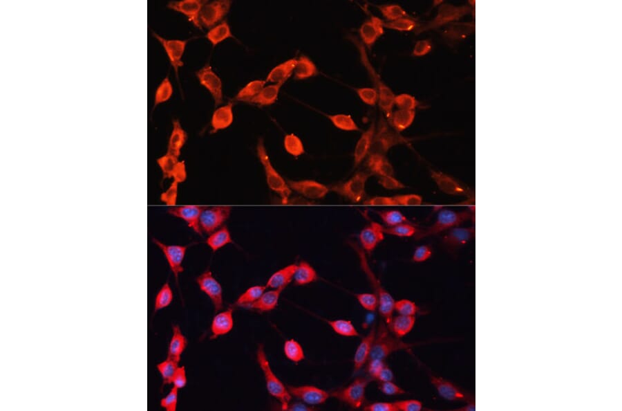 Anti-ADAMTS13 Antibody (A10432) | Antibodies.com