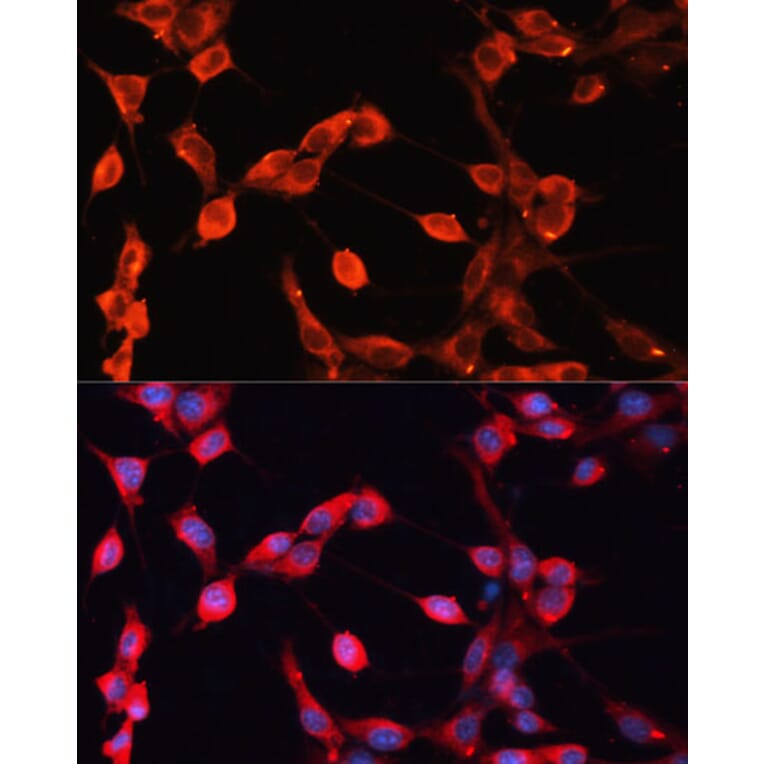 Immunofluorescence - Anti-ADAMTS13 Antibody (A10432) - Antibodies.com