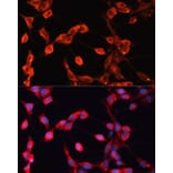 Immunofluorescence - Anti-ADAMTS13 Antibody (A10432) - Antibodies.com