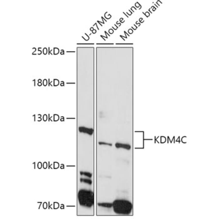 Western Blot - Anti-KDM4C/GASC1/JMJD2C Antibody (A10433) - Antibodies.com