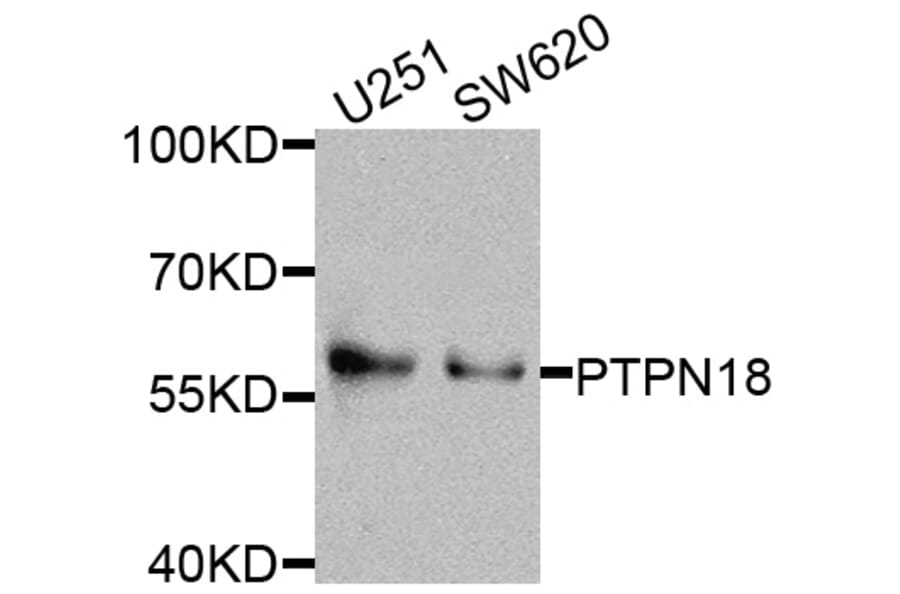 Western Blot - Anti-PTPN18 Antibody (A8487) - Antibodies.com