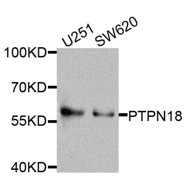 Western Blot - Anti-PTPN18 Antibody (A8487) - Antibodies.com
