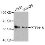 Western Blot - Anti-PTPN18 Antibody (A8487) - Antibodies.com