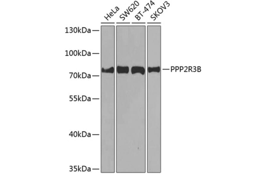 Western Blot - Anti-PPP2R3B Antibody (A10435) - Antibodies.com