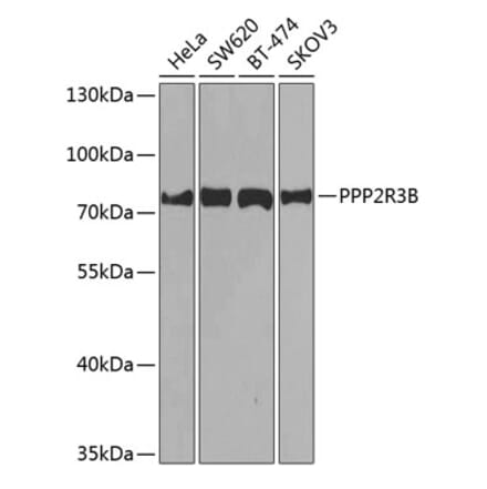 Western Blot - Anti-PPP2R3B Antibody (A10435) - Antibodies.com