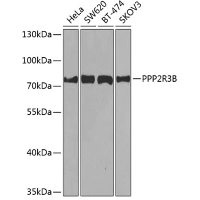 Western Blot - Anti-PPP2R3B Antibody (A10435) - Antibodies.com