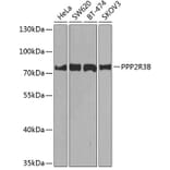 Western Blot - Anti-PPP2R3B Antibody (A10435) - Antibodies.com