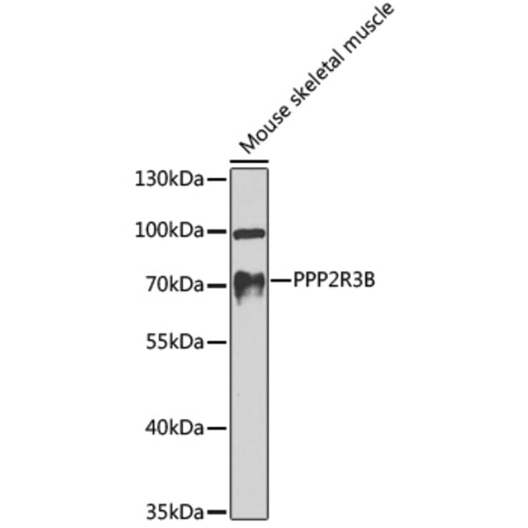 Western Blot - Anti-PPP2R3B Antibody (A10435) - Antibodies.com