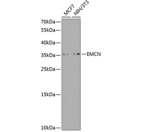 Western Blot - Anti-Endomucin Antibody (A10438) - Antibodies.com