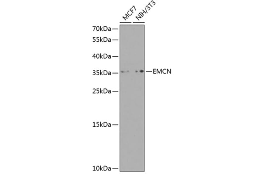 Western Blot - Anti-Endomucin Antibody (A10438) - Antibodies.com