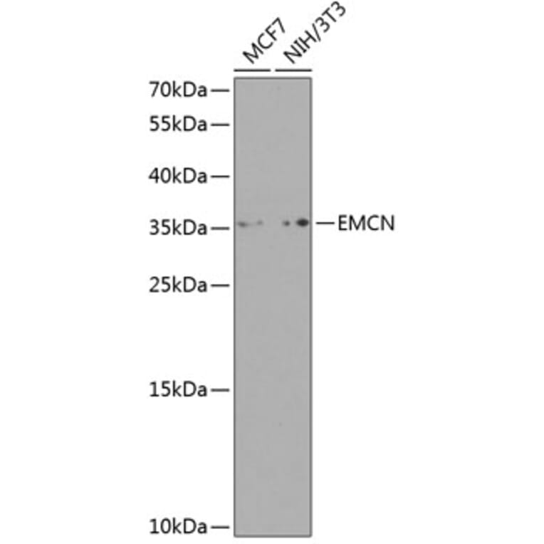 Western Blot - Anti-Endomucin Antibody (A10438) - Antibodies.com