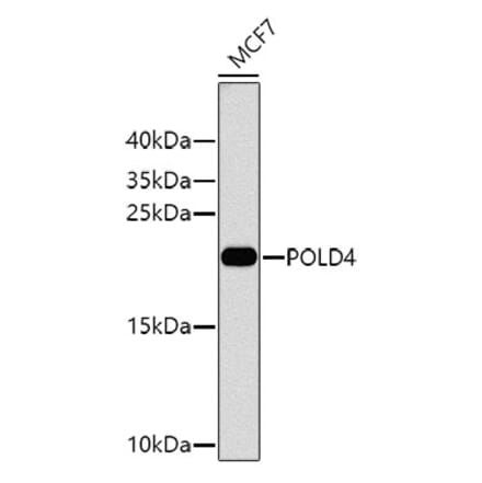 Western Blot - Anti-POLD4 Antibody (A10440) - Antibodies.com