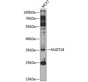 Western Blot - Anti-NUDT18 Antibody (A10441) - Antibodies.com