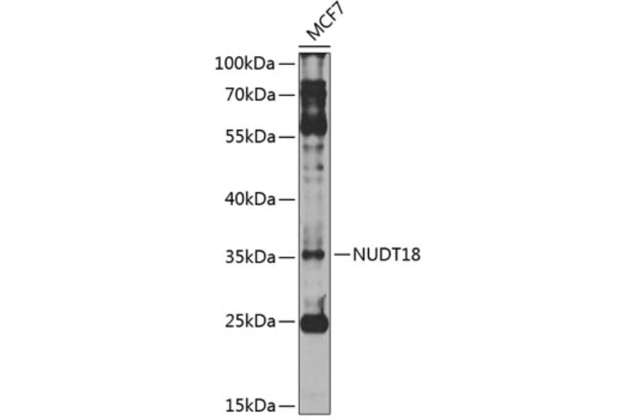 Western Blot - Anti-NUDT18 Antibody (A10441) - Antibodies.com
