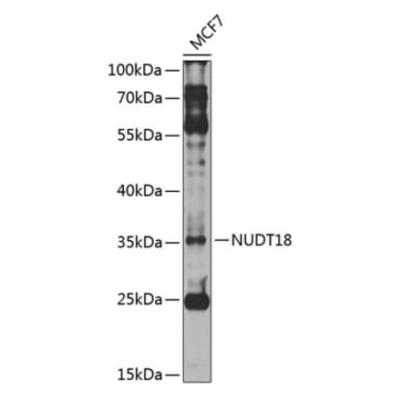 Western Blot - Anti-NUDT18 Antibody (A10441) - Antibodies.com