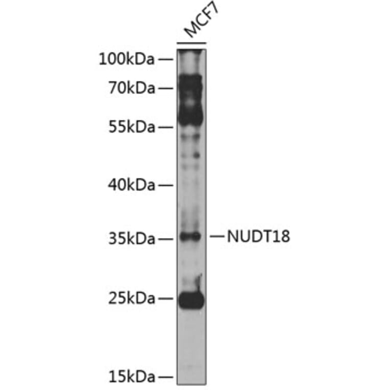 Western Blot - Anti-NUDT18 Antibody (A10441) - Antibodies.com