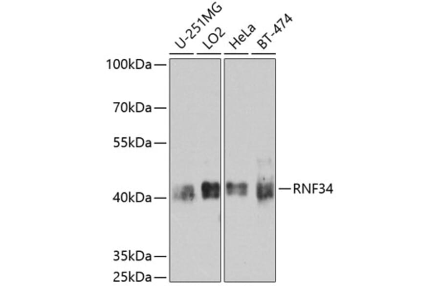 Western Blot - Anti-RNF34 Antibody (A10442) - Antibodies.com