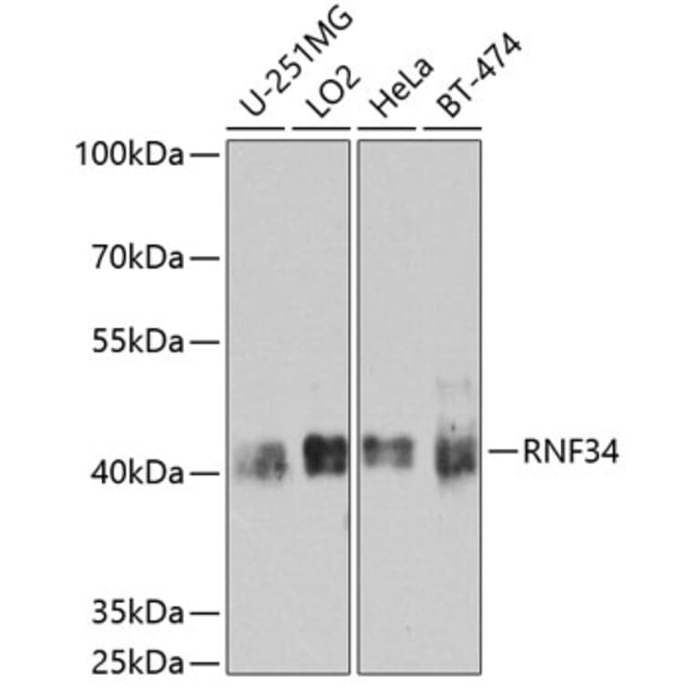 Western Blot - Anti-RNF34 Antibody (A10442) - Antibodies.com