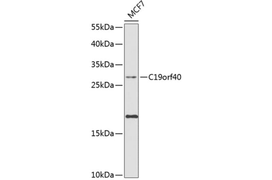 Western Blot - Anti-FAAP24 Antibody (A10443) - Antibodies.com