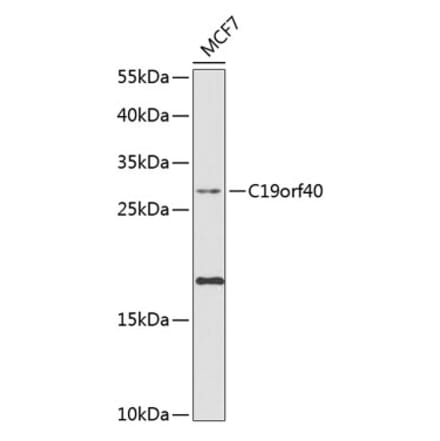 Western Blot - Anti-FAAP24 Antibody (A10443) - Antibodies.com