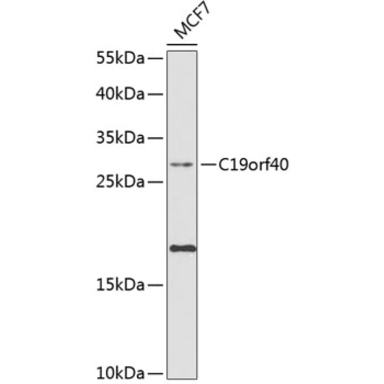 Western Blot - Anti-FAAP24 Antibody (A10443) - Antibodies.com