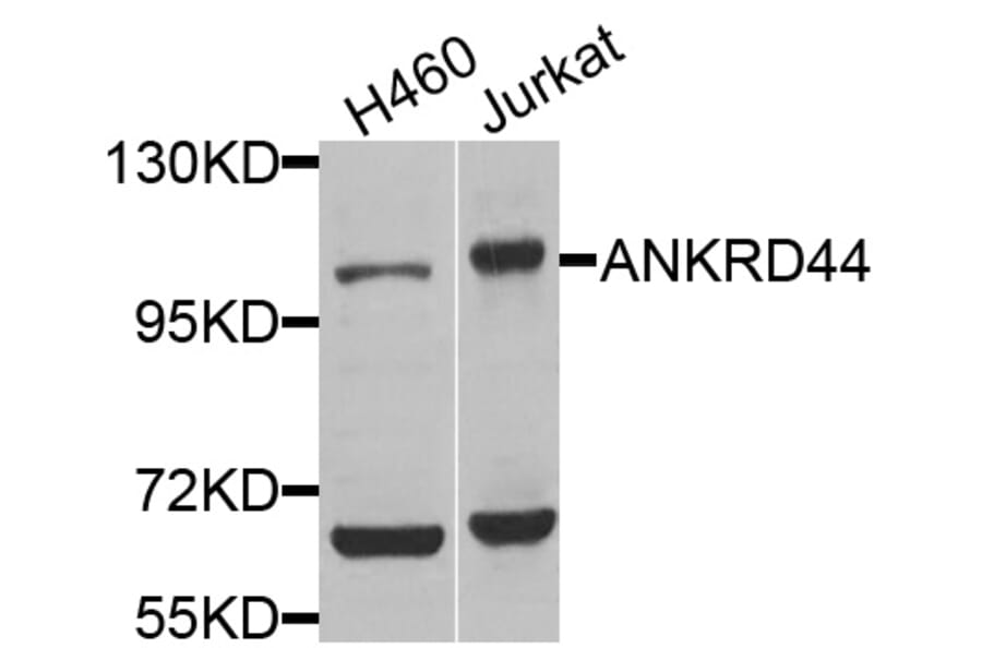 Western Blot - Anti-ANKRD44 Antibody (A8521) - Antibodies.com