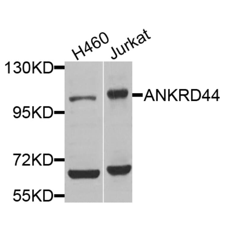Western Blot - Anti-ANKRD44 Antibody (A8521) - Antibodies.com