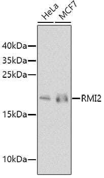 Western blot analysis of extracts of various cell lines, using Anti-RMI2 Antibody (A8523) at 1:1,000 dilution.
Secondary antibody: Goat Anti-Rabbit IgG (H+L) (HRP) (AS014) at 1:10,000 dilution.
Lysates / proteins: 25µg per lane.
Blocking buffer: 3% non-fat dry milk in TBST.
Detection: ECL Basic Kit (RM00020).
Exposure time: 90s.