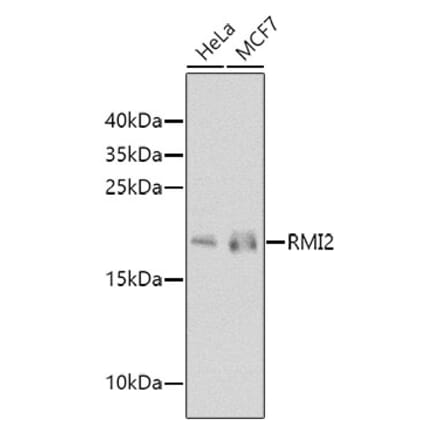 Western Blot - Anti-RMI2 Antibody (A10445) - Antibodies.com