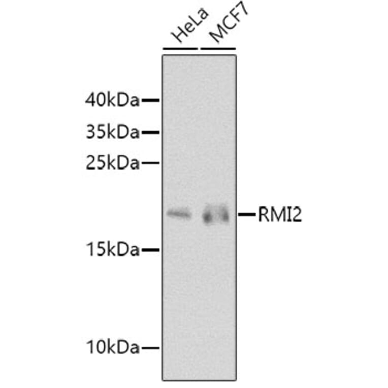 Western Blot - Anti-RMI2 Antibody (A10445) - Antibodies.com