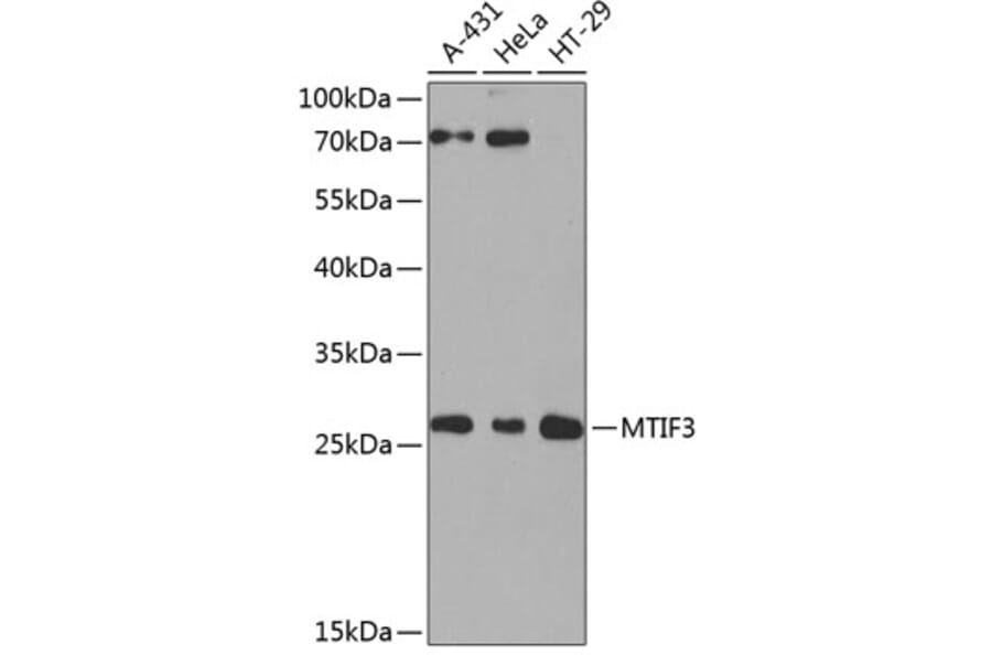 Western Blot - Anti-MTIF3 Antibody (A10446) - Antibodies.com