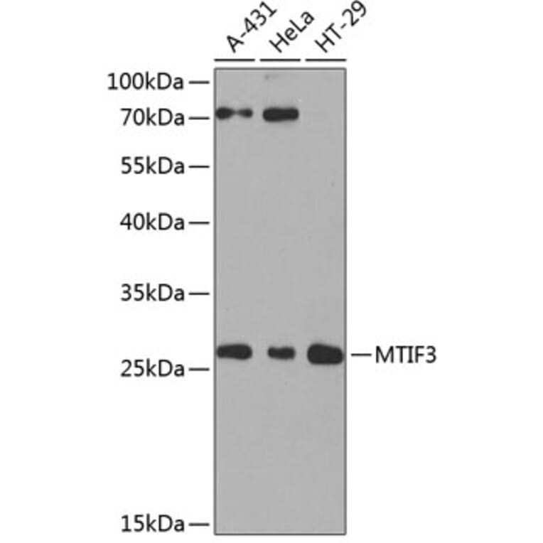 Western Blot - Anti-MTIF3 Antibody (A10446) - Antibodies.com