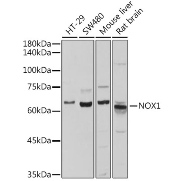 Western Blot - Anti-NOX1 Antibody (A10447) - Antibodies.com