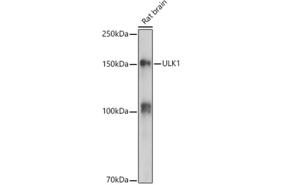 Western Blot - Anti-ULK1 Antibody (A10448) - Antibodies.com