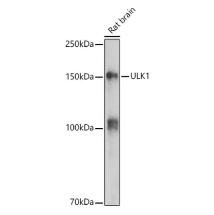 Western Blot - Anti-ULK1 Antibody (A10448) - Antibodies.com