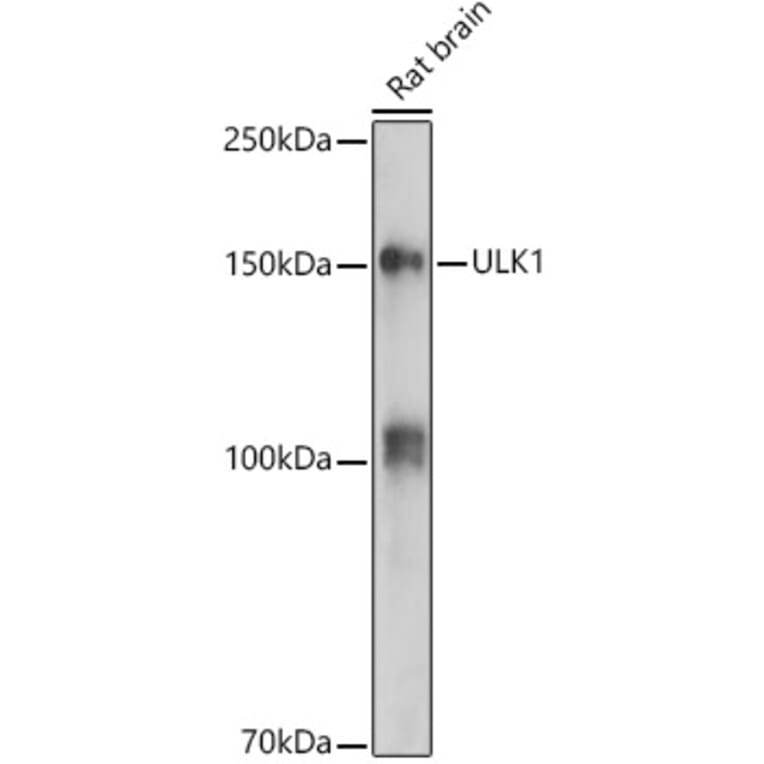 Western Blot - Anti-ULK1 Antibody (A10448) - Antibodies.com