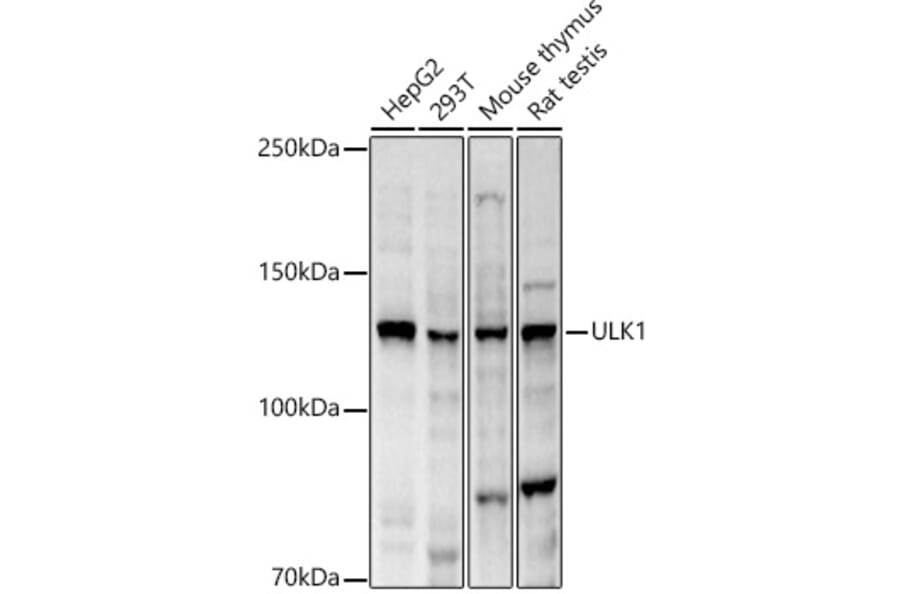Western Blot - Anti-ULK1 Antibody (A10448) - Antibodies.com