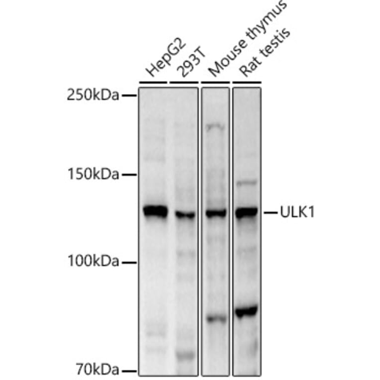 Western Blot - Anti-ULK1 Antibody (A10448) - Antibodies.com